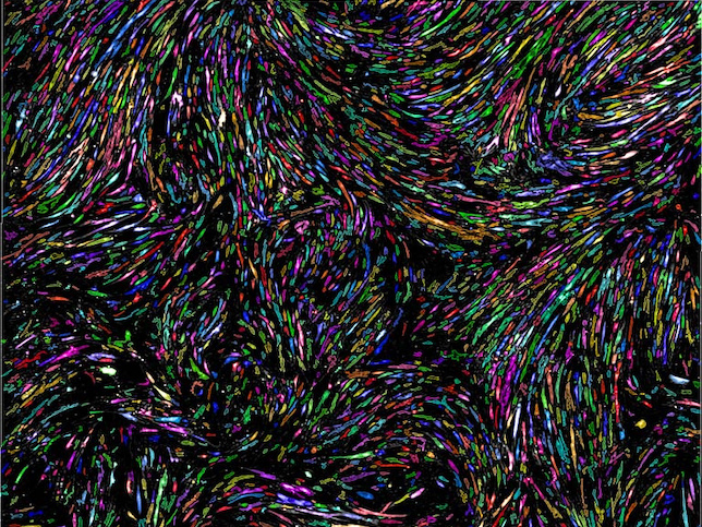 Computer assisted microscopy helps identify successful cell cultures of hard-to-grow cells. <a href="https://ki-images.mit.edu/2023/cebula-1"_blank><strong>2023 KI Image Award Winner</strong></a>